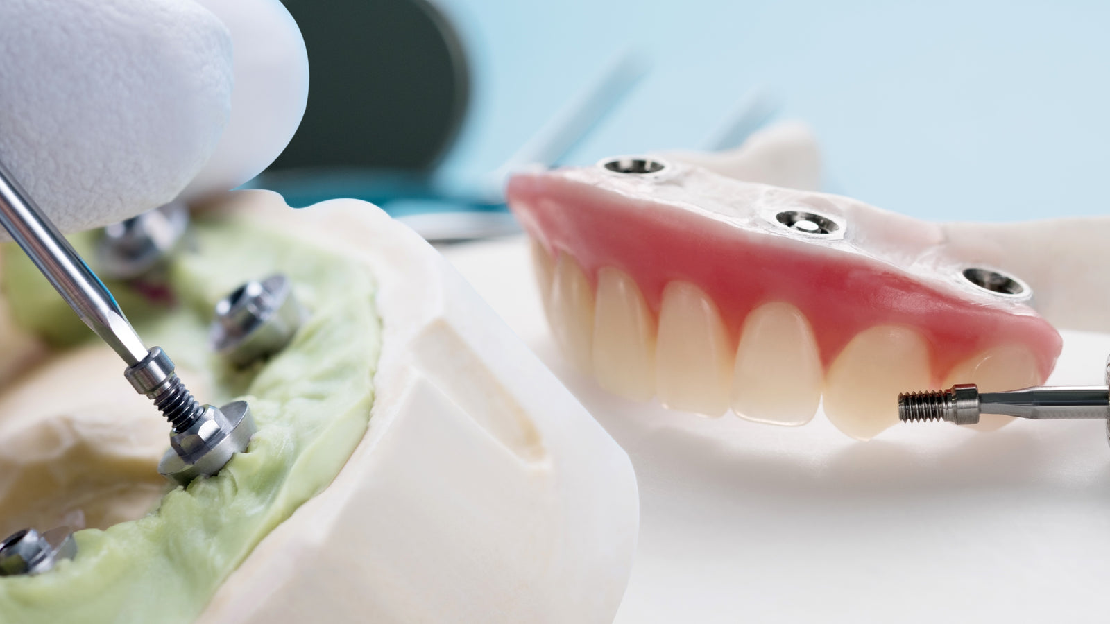 PROVISIONALES DENTALES