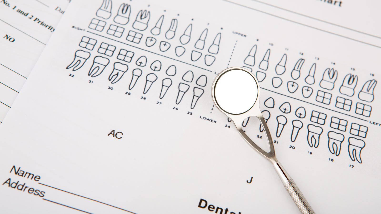FERULIZACIÓN DENTAL.